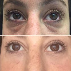 before-afters