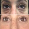 before-afters