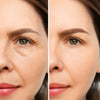 before-afters