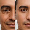 before-afters
