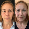 before-afters