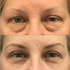 before-afters