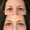 before-afters